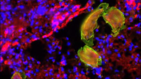 Parasitic worm (c) UCR SOM